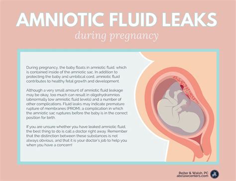 amniotic.fluid leaking|Amniotic Fluid: What is It and Signs of Leaking